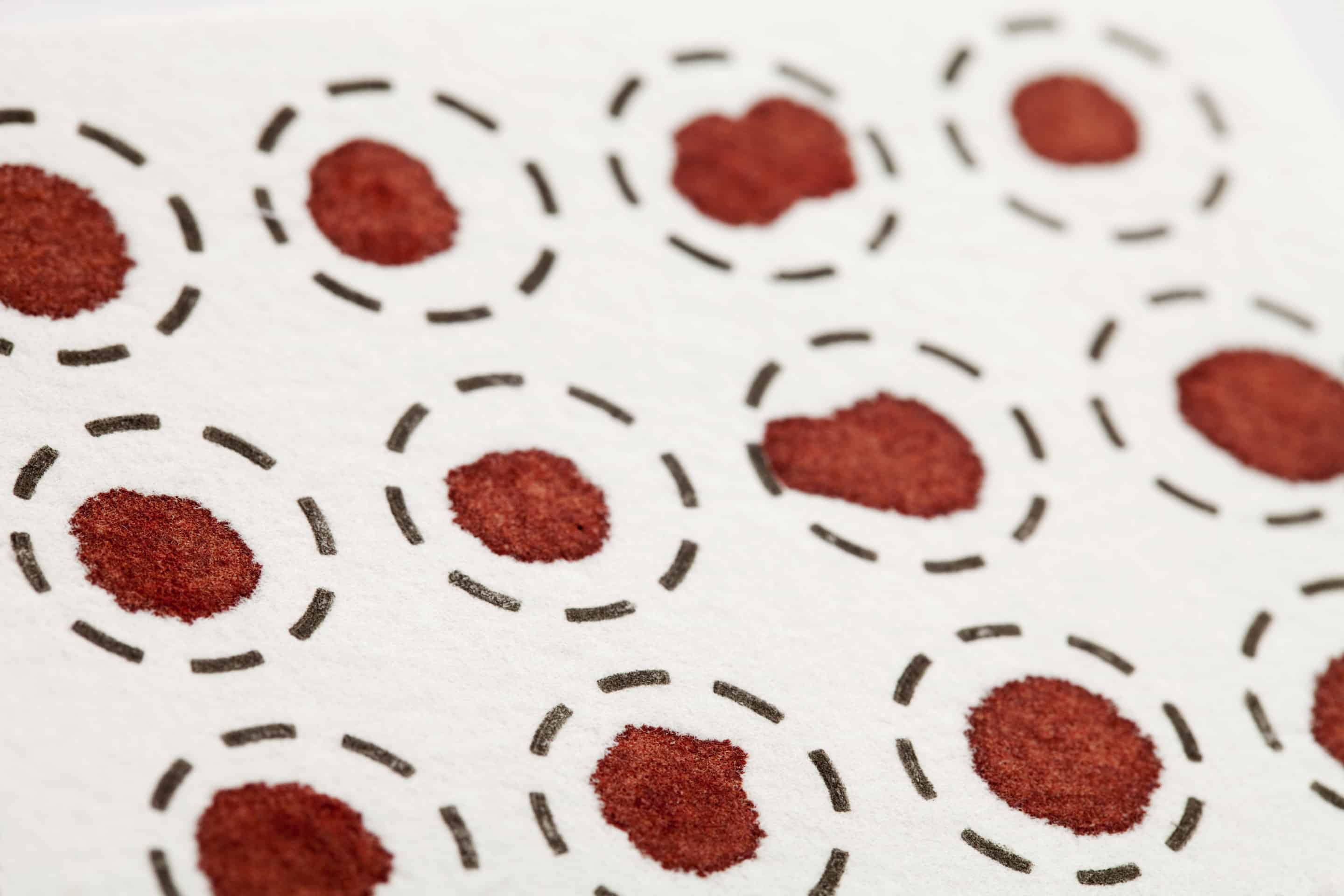 Dried Blood Spot (DBS) Card Analysis on Metabolon’s Metabolomics Platform