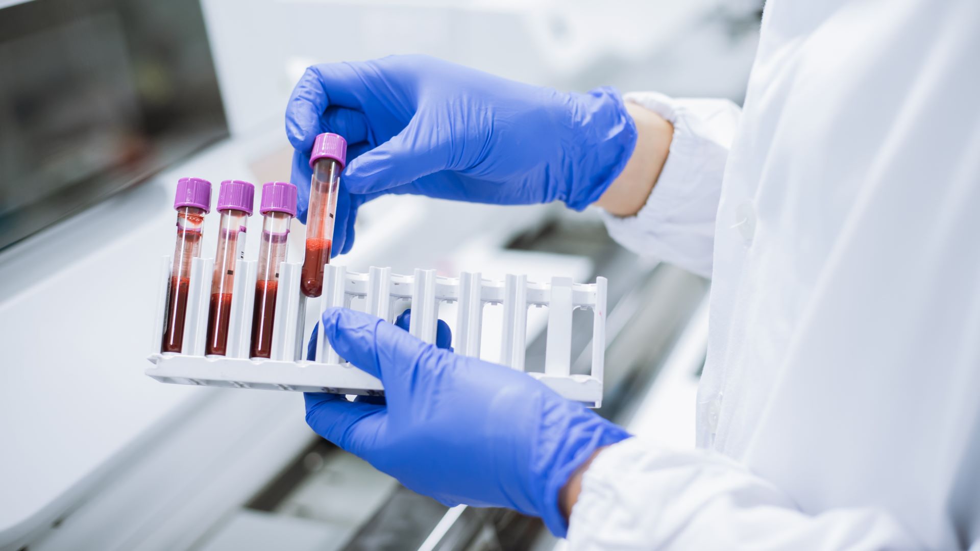 https://www.metabolon.com/wp-content/uploads/2023/08/clinician-blood-sample-tube-rack.jpg