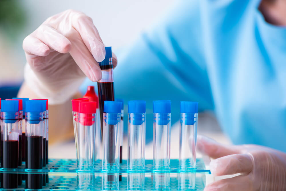 https://www.metabolon.com/wp-content/uploads/2026/08/hepatology-glass-vials-samples.jpg